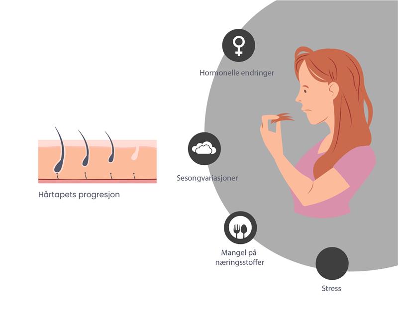 Illustrasjon som viser vanlige årsaker til hårtap hos kvinner, som hormonelle endringer, stress, sesongvariasjoner og næringsmangel.