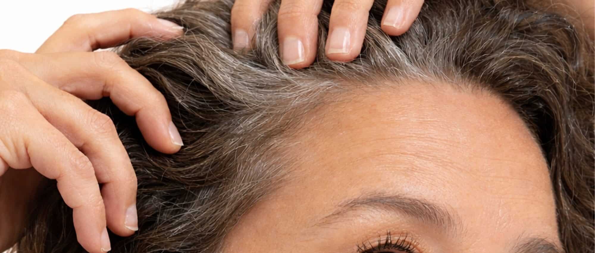 Nærbilde av kvinne som undersøker hodebunnen. Tynnere hår og synlig hodebunn er vanlige tegn på begynnende hårtap.